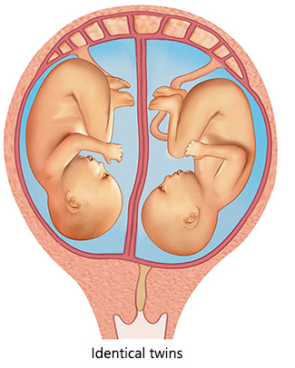 Identical twins usually share the same placenta