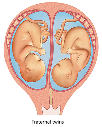 Non identical twins (fraternal twins) have their own placenta